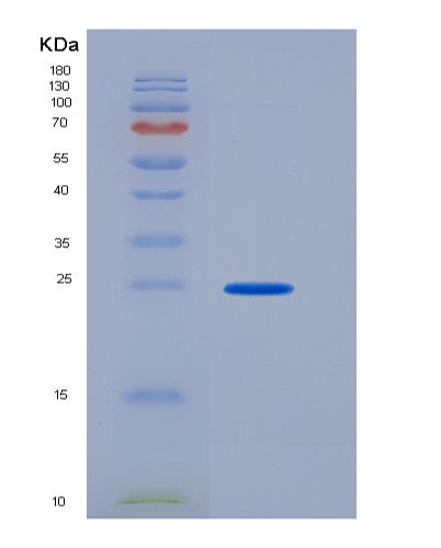 SDS-PAGE analysis of Human FCGR3A (Low Affinity Immunoglobulin Gamma Fc Region Receptor Iii-A) - Recombinant Protein, CATHuman FCGR3A (Low Affinity Immunoglobulin Gamma Fc Region Receptor Iii-A) - Recombinant Protein