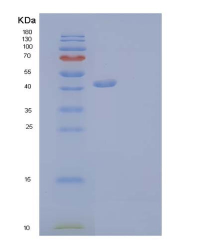 SDS-PAGE analysis of Mouse Tnfrsf18 (Tumor Necrosis Factor Receptor Superfamily Member 18) - Recombinant Protein, CAT# BLT-03718P, showing >90% purity under 15% SDS-PAGE (Reduced)Mouse Tnfrsf18 (Tumor Necrosis Factor Receptor Superfamily Member 18) - Recombinant Protein