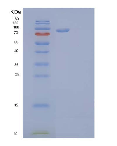 SDS-PAGE analysis of Human OSMR (Oncostatin-M-Specific Receptor Subunit Beta) - Recombinant Protein, CAT# BLT-03719P, showing >85% purity under 15% SDS-PAGE (Reduced)Human OSMR (Oncostatin-M-Specific Receptor Subunit Beta) - Recombinant Protein