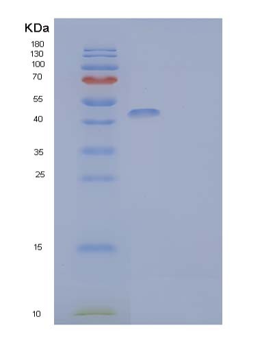SDS-PAGE analysis of Mouse Cd74 (H-2 Class Ii Histocompatibility Antigen Gamma Chain) - Recombinant Protein, CATMouse Cd74 (H-2 Class Ii Histocompatibility Antigen Gamma Chain) - Recombinant Protein