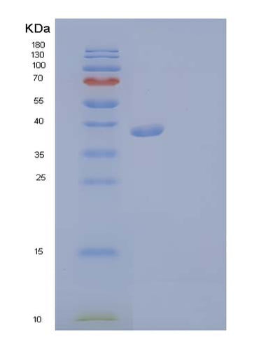 SDS-PAGE analysis of Human FGFR3 (Fibroblast Growth Factor Receptor 3) - Recombinant Protein, CAT# BLT-03727P, showing >90% purity under 15% SDS-PAGE (Reduced)Human FGFR3 (Fibroblast Growth Factor Receptor 3) - Recombinant Protein