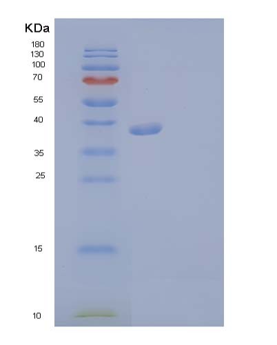 SDS-PAGE analysis of Human FGFR3 (Fibroblast Growth Factor Receptor 3) - Recombinant Protein, CATHuman FGFR3 (Fibroblast Growth Factor Receptor 3) - Recombinant Protein