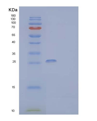 SDS-PAGE analysis of Human CD300LG (Cmrf35-Like Molecule 9) - Recombinant Protein, CAT# BLT-03730P, showing >90% purity under 15% SDS-PAGE (Reduced)Human CD300LG (Cmrf35-Like Molecule 9) - Recombinant Protein