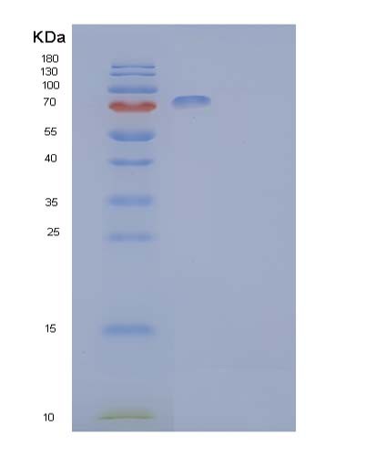 SDS-PAGE analysis of Human EPHB2 (Ephrin Type-B Receptor 2) - Recombinant Protein, CATHuman EPHB2 (Ephrin Type-B Receptor 2) - Recombinant Protein