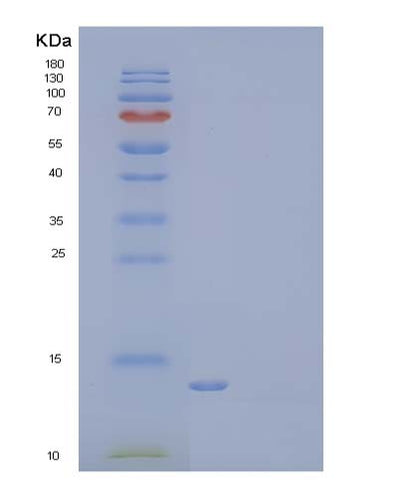 SDS-PAGE analysis of Mouse Lair1 (Leukocyte-Associated Immunoglobulin-Like Receptor 1) - Recombinant Protein, CAT# BLT-03734P, showing >85% purity under 15% SDS-PAGE (Reduced)Mouse Lair1 (Leukocyte-Associated Immunoglobulin-Like Receptor 1) - Recombinant Protein