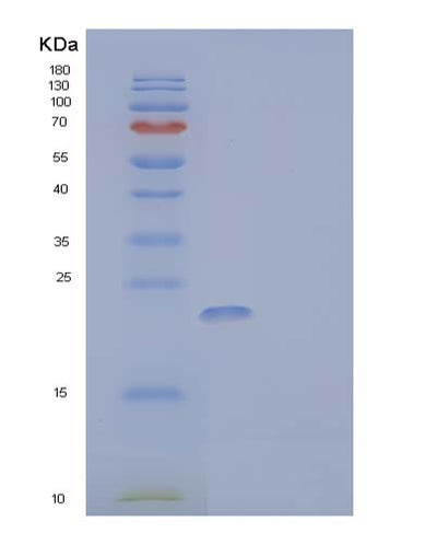 SDS-PAGE analysis of Human PTH1R (Parathyroid Hormone/Parathyroid Hormone-Related Peptide Receptor) - Recombinant Protein, CAT# BLT-03738P, showing >95% purity under 15% SDS-PAGE (Reduced)Human PTH1R (Parathyroid Hormone/Parathyroid Hormone-Related Peptide Receptor) - Recombinant Protein