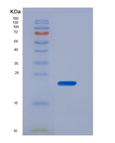 SDS-PAGE analysis of Human FCGR3B (Low Affinity Immunoglobulin Gamma Fc Region Receptor Iii-B) - Recombinant Protein, CAT# BLT-04998P, showing >85% purity under 15% SDS-PAGE (Reduced)Human FCGR3B (Low Affinity Immunoglobulin Gamma Fc Region Receptor Iii-B) - Recombinant Protein