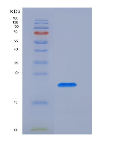 SDS-PAGE analysis of Human FCGR3B (Low Affinity Immunoglobulin Gamma Fc Region Receptor Iii-B) - Recombinant Protein, CAT# BLT-03817P, showing >85% purity under 15% SDS-PAGE (Reduced)Human FCGR3B (Low Affinity Immunoglobulin Gamma Fc Region Receptor Iii-B) - Recombinant Protein