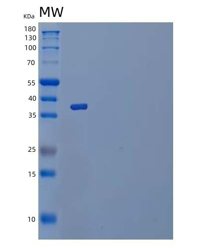 SDS-PAGE analysis of Mouse Il1r2 (Interleukin-1 Receptor Type 2) - Recombinant Protein, CAT# BLT-03836P, showing >85% purity under 15% SDS-PAGE (Reduced)Mouse Il1r2 (Interleukin-1 Receptor Type 2) - Recombinant Protein