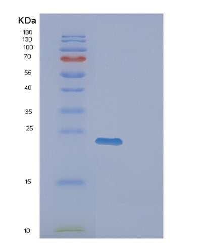 SDS-PAGE analysis of Human EXOSC1 (Exosome Complex Component Csl4) - Recombinant Protein, CAT# BLT-01019P, showing >95% purity under 15% SDS-PAGE (Reduced)Human EXOSC1 (Exosome Complex Component Csl4) - Recombinant Protein