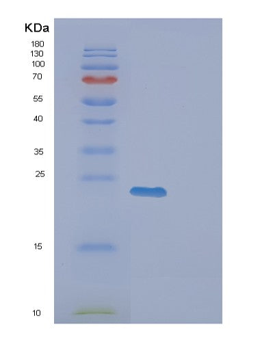 SDS-PAGE analysis of Human EXOSC1 (Exosome Complex Component Csl4) - Recombinant Protein, CATHuman EXOSC1 (Exosome Complex Component Csl4) - Recombinant Protein