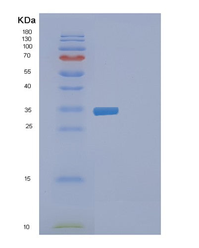 SDS-PAGE analysis of Human EXOSC7 (Exosome Complex Component Rrp42) - Recombinant Protein, CATHuman EXOSC7 (Exosome Complex Component Rrp42) - Recombinant Protein