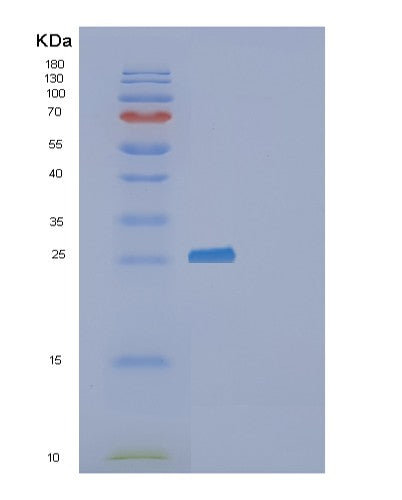 SDS-PAGE analysis of Human F3 (Tissue Factor) - Recombinant Protein, CATHuman F3 (Tissue Factor) - Recombinant Protein