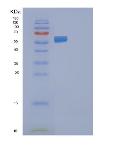 SDS-PAGE analysis of Human FAAH2 (Fatty-Acid Amide Hydrolase 2) - Recombinant Protein, CAT# BLT-01030P, showing >85% purity under 15% SDS-PAGE (Reduced)Human FAAH2 (Fatty-Acid Amide Hydrolase 2) - Recombinant Protein