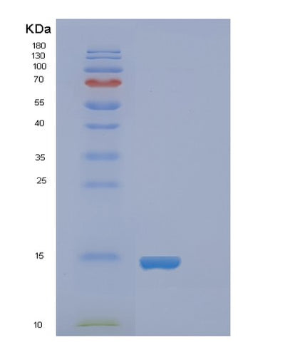SDS-PAGE analysis of Human FABP4 (Fatty Acid-Binding Protein, Adipocyte) - Recombinant Protein, CAT# BLT-01035P, showing >85% purity under 15% SDS-PAGE (Reduced)Human FABP4 (Fatty Acid-Binding Protein, Adipocyte) - Recombinant Protein