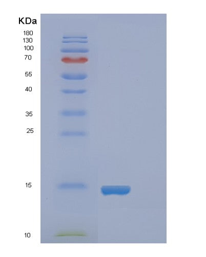 SDS-PAGE analysis of Human FABP4 (Fatty Acid-Binding Protein, Adipocyte) - Recombinant Protein, CATHuman FABP4 (Fatty Acid-Binding Protein, Adipocyte) - Recombinant Protein