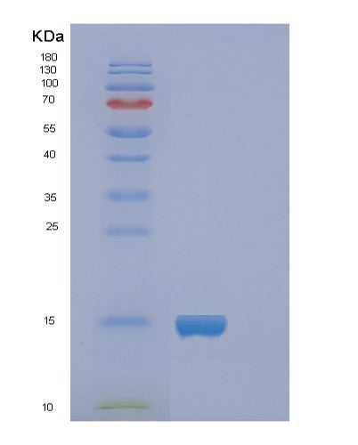 SDS-PAGE analysis of Human FABP5 (Fatty Acid-Binding Protein 5) - Recombinant Protein, CATHuman FABP5 (Fatty Acid-Binding Protein 5) - Recombinant Protein