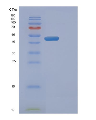SDS-PAGE analysis of Human FADD (Fas-Associated Death Domain Protein) - Recombinant Protein, CAT# BLT-01041P, showing >85% purity under 15% SDS-PAGE (Reduced)Human FADD (Fas-Associated Death Domain Protein) - Recombinant Protein