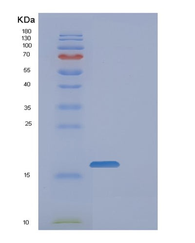 SDS-PAGE analysis of Human FAM107B (Protein Fam107B) - Recombinant Protein, CAT# BLT-01044P, showing >85% purity under 15% SDS-PAGE (Reduced)Human FAM107B (Protein Fam107B) - Recombinant Protein