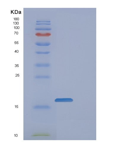 SDS-PAGE analysis of Human FAM107B (Protein Fam107B) - Recombinant Protein, CATHuman FAM107B (Protein Fam107B) - Recombinant Protein