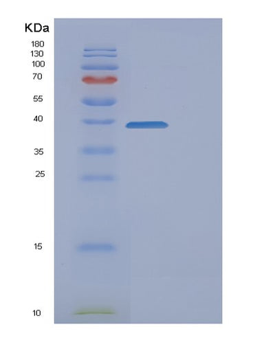 SDS-PAGE analysis of Human CYRIB (Cyfip-Related Rac1 Interactor B) - Recombinant Protein, CAT# BLT-01046P, showing >90% purity under 15% SDS-PAGE (Reduced)Human CYRIB (Cyfip-Related Rac1 Interactor B) - Recombinant Protein