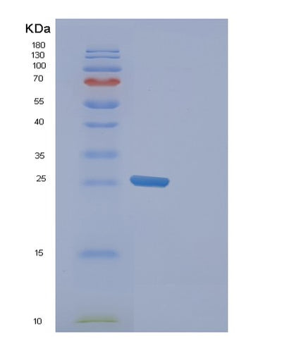 SDS-PAGE analysis of Human FAM50A (Protein Fam50A) - Recombinant Protein, CAT# BLT-01047P, showing >85% purity under 15% SDS-PAGE (Reduced)Human FAM50A (Protein Fam50A) - Recombinant Protein
