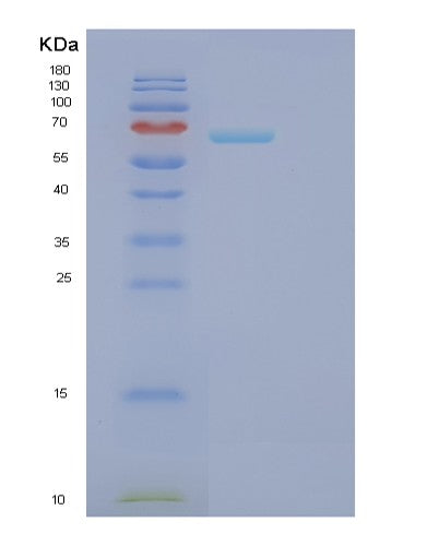 SDS-PAGE analysis of Human FARSB (Phenylalanine--Trna Ligase Beta Subunit) - Recombinant Protein, CATHuman FARSB (Phenylalanine--Trna Ligase Beta Subunit) - Recombinant Protein