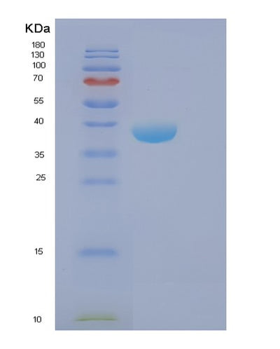 SDS-PAGE analysis of Human FBP2 (Fructose-1,6-Bisphosphatase Isozyme 2) - Recombinant Protein, CAT# BLT-01058P, showing >90% purity under 15% SDS-PAGE (Reduced)Human FBP2 (Fructose-1,6-Bisphosphatase Isozyme 2) - Recombinant Protein