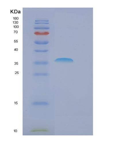 SDS-PAGE analysis of Human FBXO6 (F-Box Only Protein 6) - Recombinant Protein, CAT# BLT-01060P, showing >95% purity under 15% SDS-PAGE (Reduced)Human FBXO6 (F-Box Only Protein 6) - Recombinant Protein