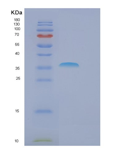 SDS-PAGE analysis of Human FBXO6 (F-Box Only Protein 6) - Recombinant Protein, CATHuman FBXO6 (F-Box Only Protein 6) - Recombinant Protein