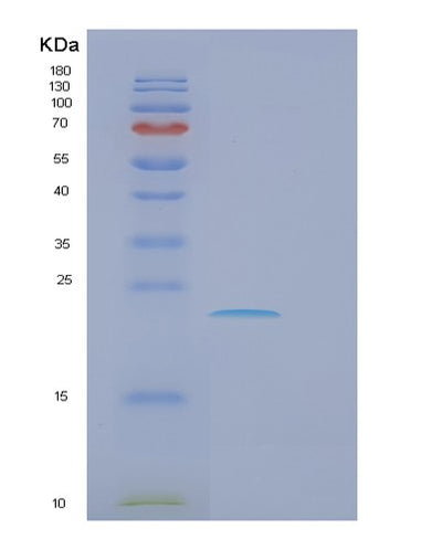 SDS-PAGE analysis of Human FCER1A (High Affinity Immunoglobulin Epsilon Receptor Subunit Alpha) - Recombinant Protein, CAT# BLT-01061P, showing >90% purity under 15% SDS-PAGE (Reduced)Human FCER1A (High Affinity Immunoglobulin Epsilon Receptor Subunit Alpha) - Recombinant Protein