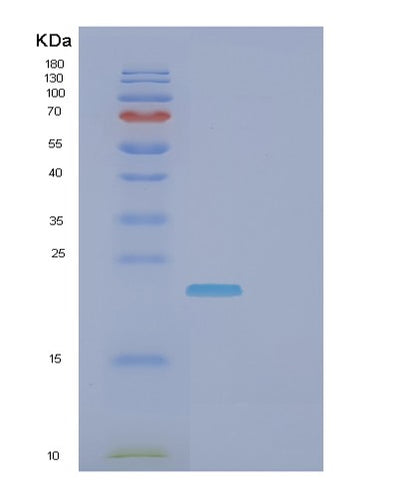 SDS-PAGE analysis of Human FCGR3A (Low Affinity Immunoglobulin Gamma Fc Region Receptor Iii-A) - Recombinant Protein, CAT# BLT-01066P, showing >90% purity under 15% SDS-PAGE (Reduced)Human FCGR3A (Low Affinity Immunoglobulin Gamma Fc Region Receptor Iii-A) - Recombinant Protein