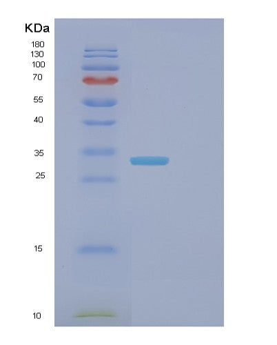 SDS-PAGE analysis of Mouse Fcgrt (Igg Receptor Fcrn Large Subunit P51) - Recombinant Protein, CATMouse Fcgrt (Igg Receptor Fcrn Large Subunit P51) - Recombinant Protein