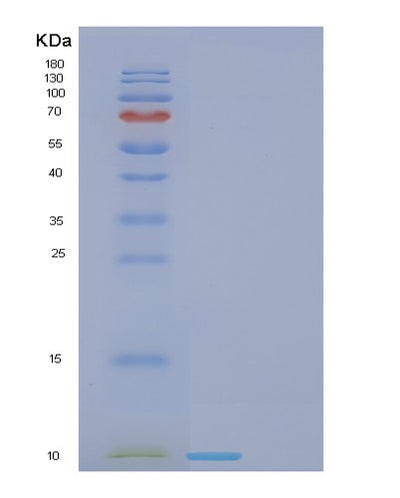 SDS-PAGE analysis of Human FDCSP (Follicular Dendritic Cell Secreted Peptide) - Recombinant Protein, CAT# BLT-01068P, showing >85% purity under 15% SDS-PAGE (Reduced)Human FDCSP (Follicular Dendritic Cell Secreted Peptide) - Recombinant Protein