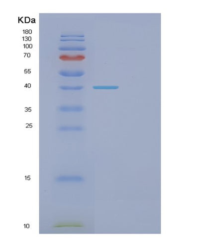 SDS-PAGE analysis of Human FEN1 (Flap Endonuclease 1) - Recombinant Protein, CAT# BLT-01070P, showing >90% purity under 15% SDS-PAGE (Reduced)Human FEN1 (Flap Endonuclease 1) - Recombinant Protein