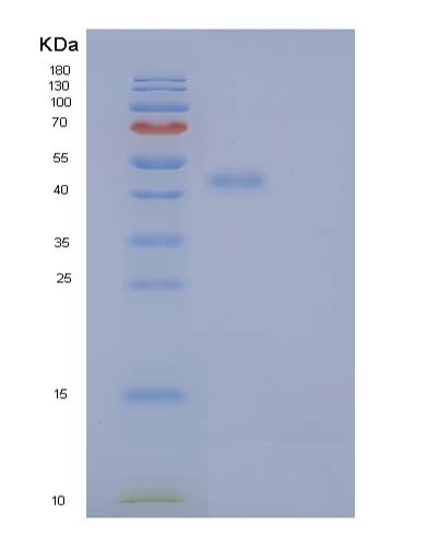 SDS-PAGE analysis of Human ERP44 (Endoplasmic Reticulum Resident Protein 44) - Recombinant Protein, CATHuman ERP44 (Endoplasmic Reticulum Resident Protein 44) - Recombinant Protein