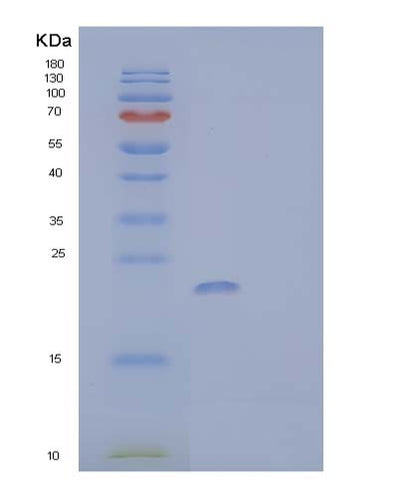 SDS-PAGE analysis of Human BIRC5 (Baculoviral Iap Repeat-Containing Protein 5) - Recombinant Protein, CAT# BLT-03942P, showing >85% purity under 15% SDS-PAGE (Reduced)Human BIRC5 (Baculoviral Iap Repeat-Containing Protein 5) - Recombinant Protein