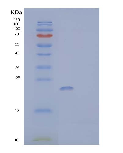 SDS-PAGE analysis of Human BIRC5 (Baculoviral Iap Repeat-Containing Protein 5) - Recombinant Protein, CATHuman BIRC5 (Baculoviral Iap Repeat-Containing Protein 5) - Recombinant Protein