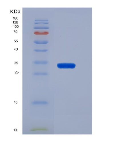 SDS-PAGE analysis of Human CD19 (B-Lymphocyte Antigen Cd19) - Recombinant Protein, CAT# BLT-03955P, showing >95% purity under 15% SDS-PAGE (Reduced)Human CD19 (B-Lymphocyte Antigen Cd19) - Recombinant Protein