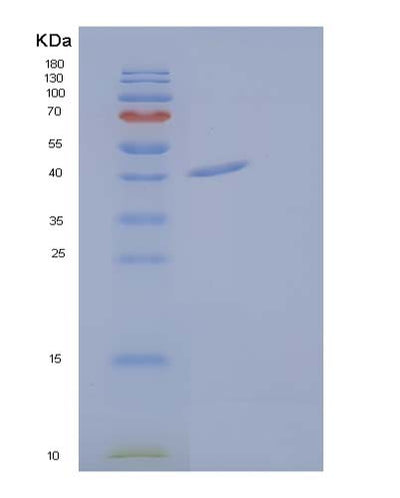 SDS-PAGE analysis of Human CALR3 (Calreticulin-3) - Recombinant Protein, CAT# BLT-03974P, showing >90% purity under 15% SDS-PAGE (Reduced)Human CALR3 (Calreticulin-3) - Recombinant Protein