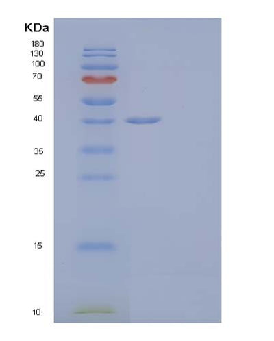 SDS-PAGE analysis of Human ALDOC (Fructose-Bisphosphate Aldolase C) - Recombinant Protein, CAT# BLT-03983P, showing >90% purity under 15% SDS-PAGE (Reduced)Human ALDOC (Fructose-Bisphosphate Aldolase C) - Recombinant Protein