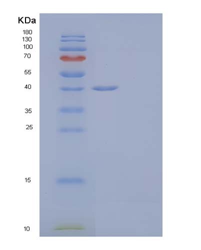 SDS-PAGE analysis of Human ALDOC (Fructose-Bisphosphate Aldolase C) - Recombinant Protein, CATHuman ALDOC (Fructose-Bisphosphate Aldolase C) - Recombinant Protein