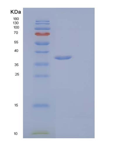 SDS-PAGE analysis of Human IL1R1 (Interleukin-1 Receptor Type 1) - Recombinant Protein, CAT# BLT-03985P, showing >95% purity under 15% SDS-PAGE (Reduced)Human IL1R1 (Interleukin-1 Receptor Type 1) - Recombinant Protein
