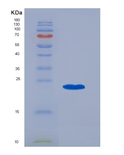 SDS-PAGE analysis of Human MS4A1 (B-Lymphocyte Antigen Cd20) - Recombinant Protein, CATHuman MS4A1 (B-Lymphocyte Antigen Cd20) - Recombinant Protein