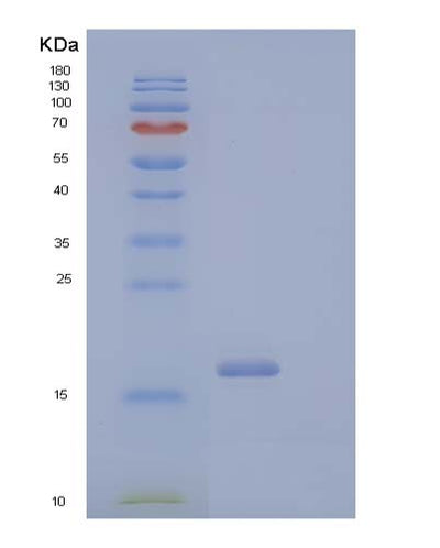 SDS-PAGE analysis of Human CD40LG (Cd40 Ligand) - Recombinant Protein, CAT# BLT-04010P, showing >90% purity under 15% SDS-PAGE (Reduced)Human CD40LG (Cd40 Ligand) - Recombinant Protein
