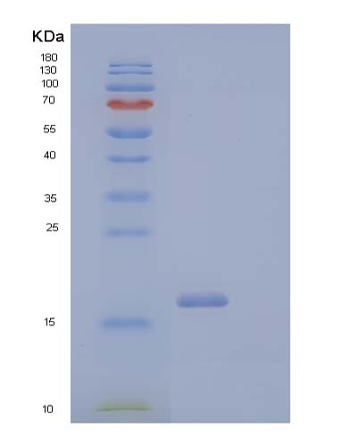SDS-PAGE analysis of Human CD40LG (Cd40 Ligand) - Recombinant Protein, CATHuman CD40LG (Cd40 Ligand) - Recombinant Protein