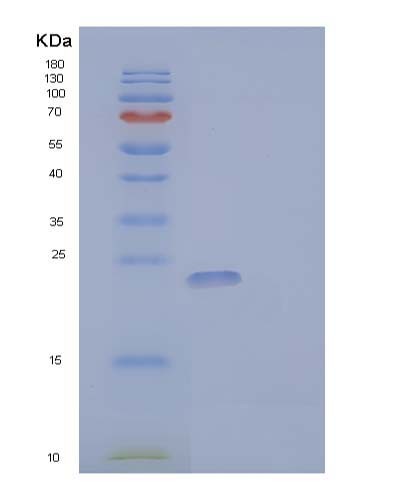 SDS-PAGE analysis of Human CSF3 (Granulocyte Colony-Stimulating Factor) - Recombinant Protein, CATHuman CSF3 (Granulocyte Colony-Stimulating Factor) - Recombinant Protein