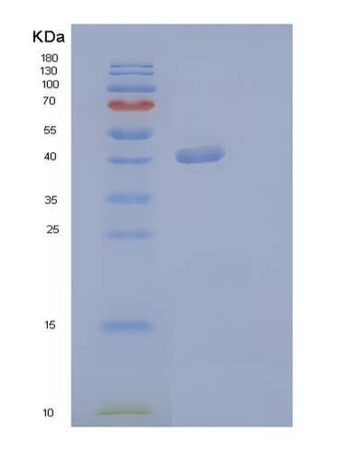 SDS-PAGE analysis of Human CSF3 (Granulocyte Colony-Stimulating Factor) - Recombinant Protein, CAT# BLT-04025P, showing >90% purity under 15% SDS-PAGE (Reduced)Human CSF3 (Granulocyte Colony-Stimulating Factor) - Recombinant Protein