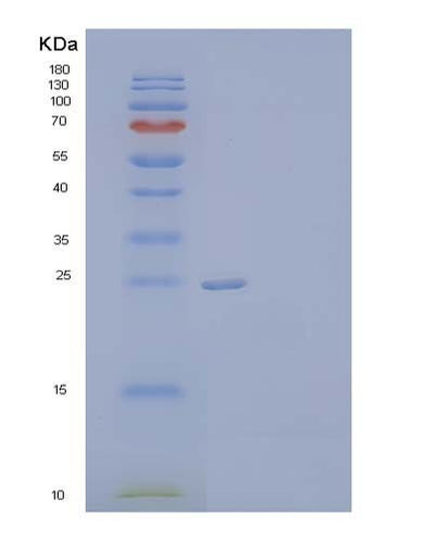 SDS-PAGE analysis of Human CHRNB3 (Neuronal Acetylcholine Receptor Subunit Beta-3) - Recombinant Protein, CAT# BLT-04039P, showing >95% purity under 15% SDS-PAGE (Reduced)Human CHRNB3 (Neuronal Acetylcholine Receptor Subunit Beta-3) - Recombinant Protein