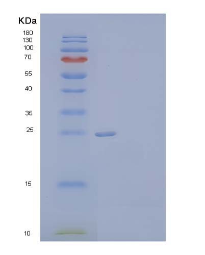 SDS-PAGE analysis of Human CHRNB3 (Neuronal Acetylcholine Receptor Subunit Beta-3) - Recombinant Protein, CATHuman CHRNB3 (Neuronal Acetylcholine Receptor Subunit Beta-3) - Recombinant Protein